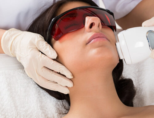 On Laser Hair Removal
